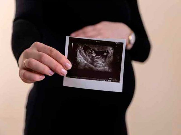 vida aborto defensa